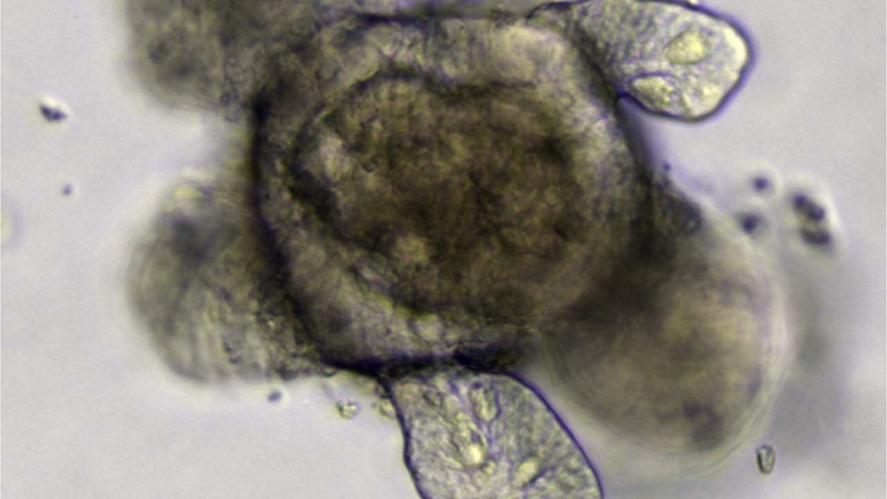 organoid