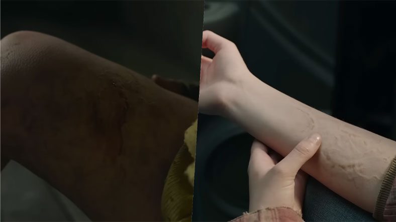 Ellie'nin bağışlanması ve annesinin ısırılması