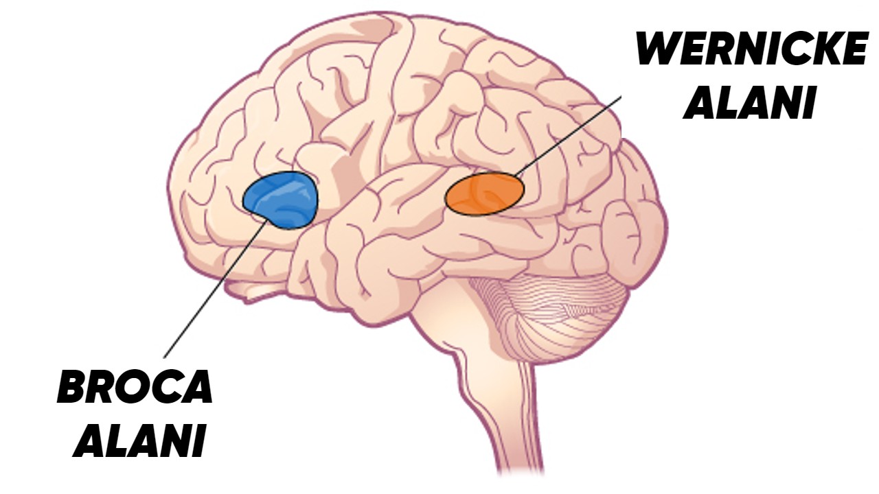 broca wernicke